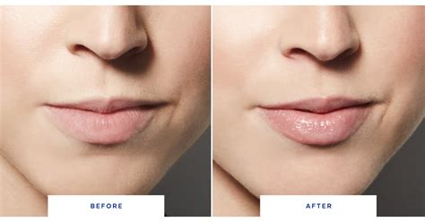 before and after dior lip plumper|Dior beauty lip gloss reviews.